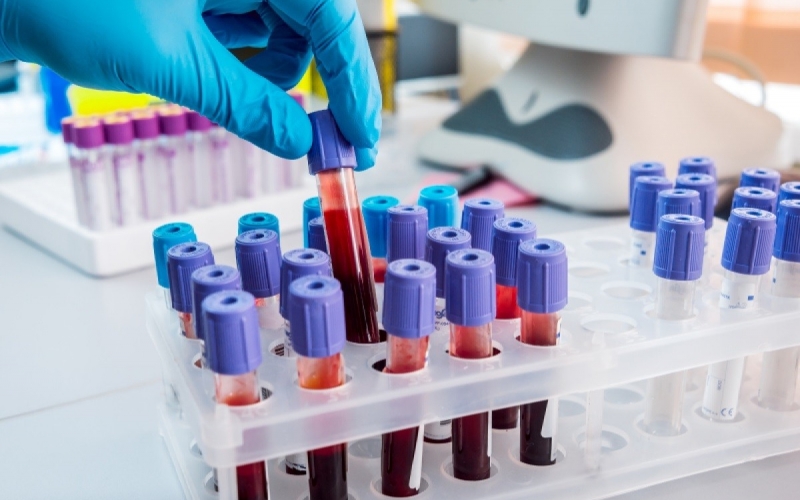 Prefeitura amplia em 50% a oferta de exames laboratoriais